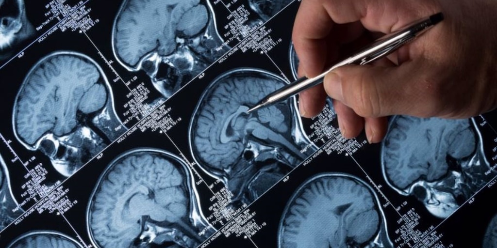 Un estudio revela efectos hasta ahora desconocidos de la depresión en la salud física